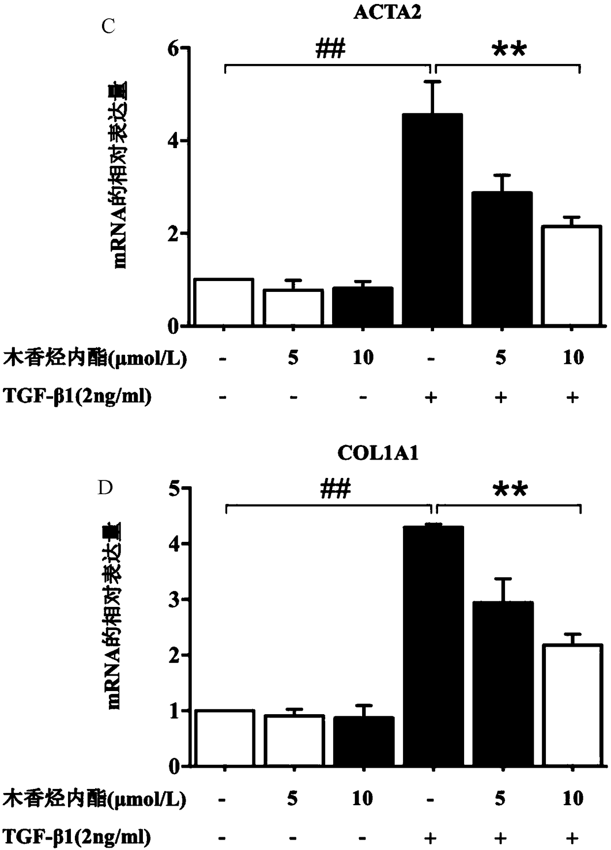 Application of costunolide in preparation of anti-hepatic fibrosis drugs