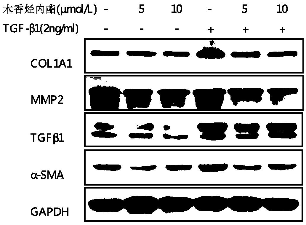 Application of costunolide in preparation of anti-hepatic fibrosis drugs