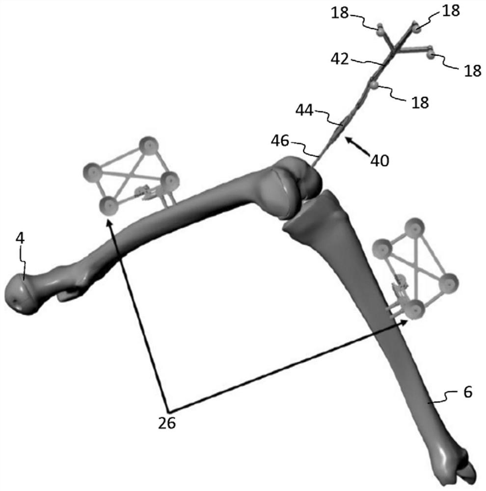 Instruments for navigated orthopedic surgeries