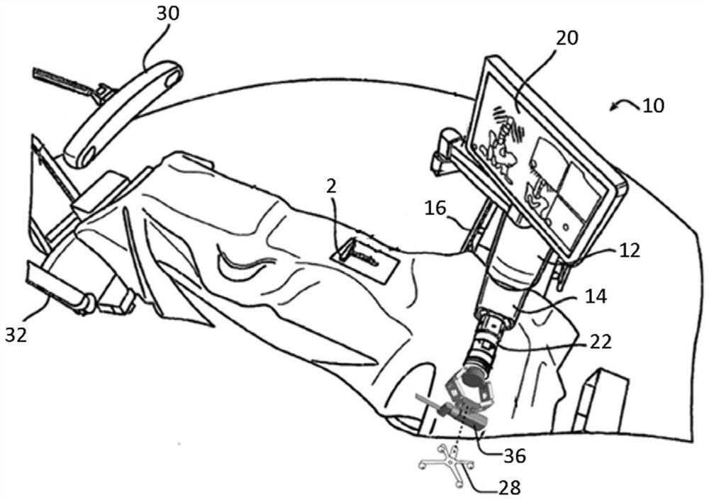 Instruments for navigated orthopedic surgeries