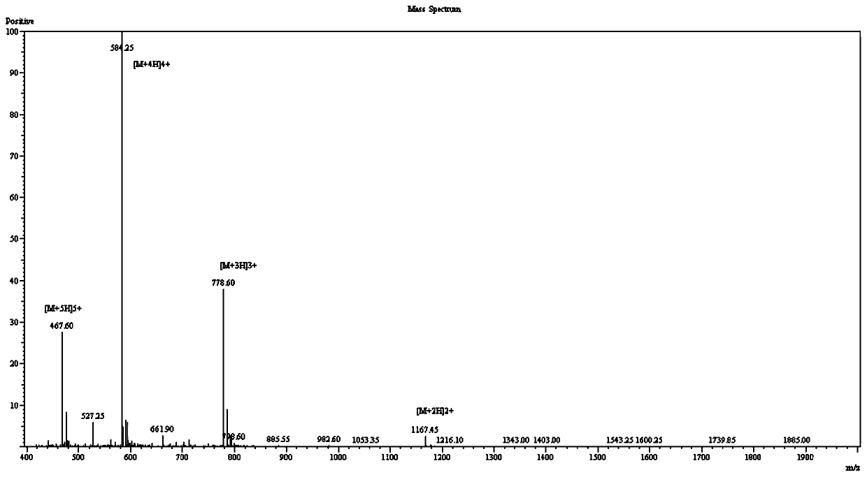 Porcine neuronal interleukin B polypeptide, and preparation method and application of polyclonal antibody thereof