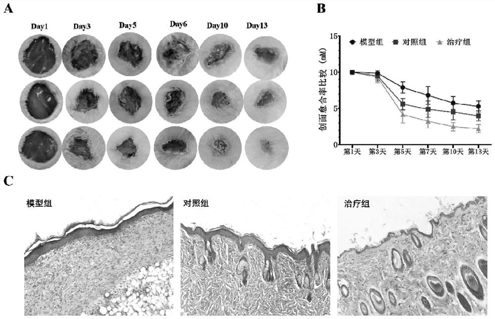 Preparation method and application of human mesenchymal stem cell supernatant dry powder gel