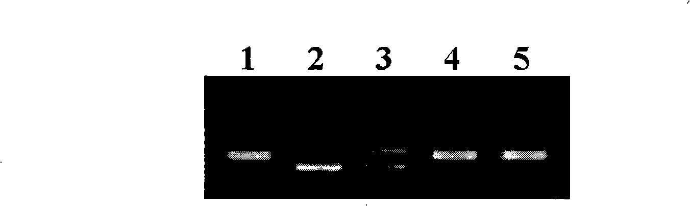 Numerator mark concatenated with whitebacked planthopper resistance genes of rice, and developing method thereof