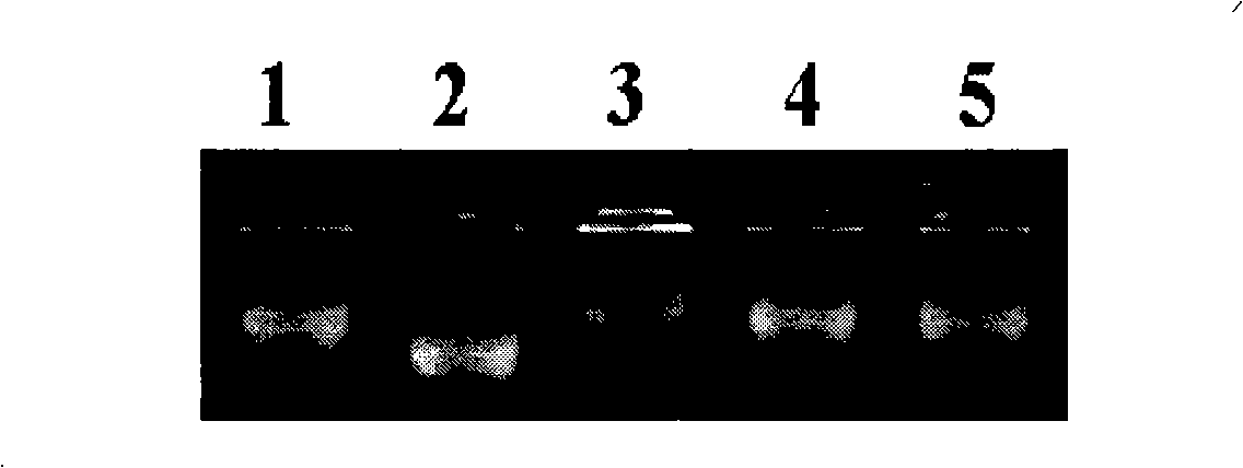 Numerator mark concatenated with whitebacked planthopper resistance genes of rice, and developing method thereof