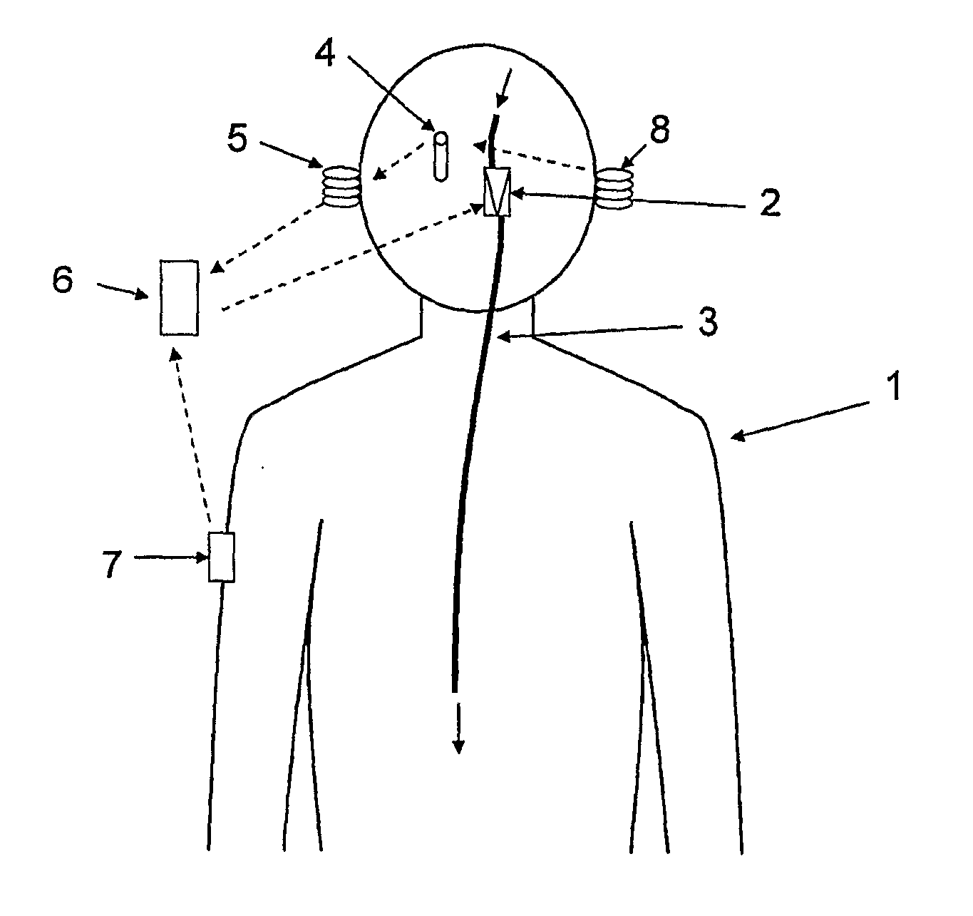 System for regulating intracranial pressure