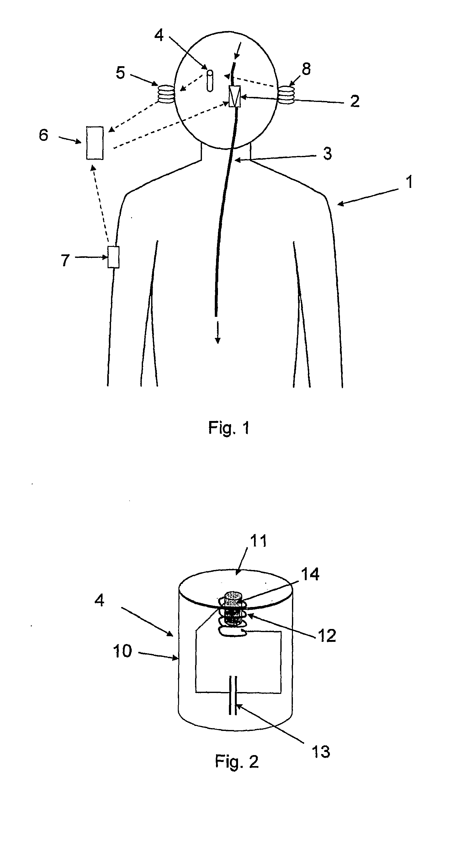 System for regulating intracranial pressure