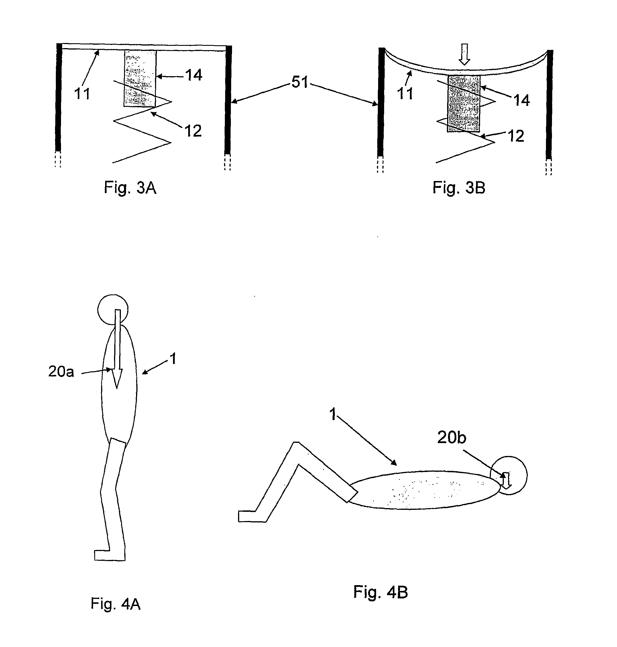 System for regulating intracranial pressure