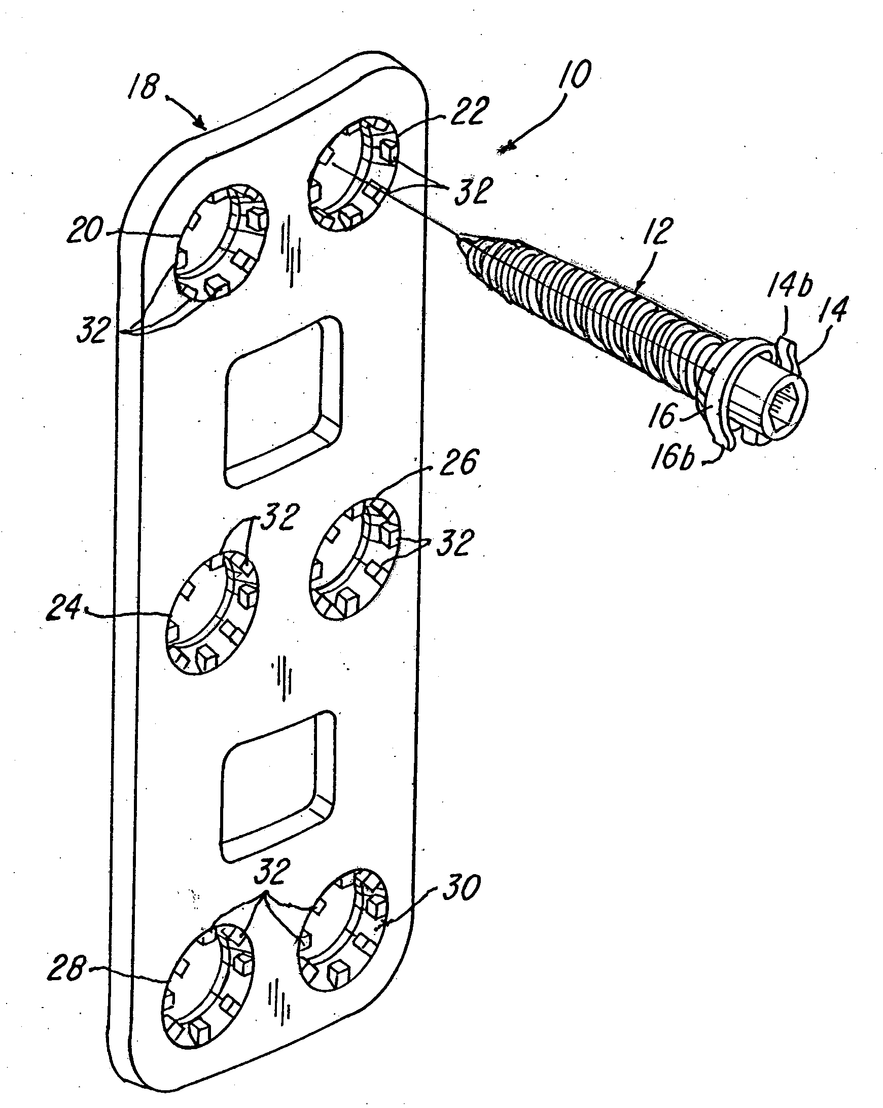 Implant plate screw locking system and screw having a locking member