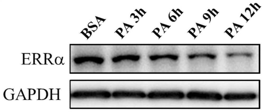 Medical application of encoding gene ESRRA of estrogen-related receptor alpha (ERR alpha)