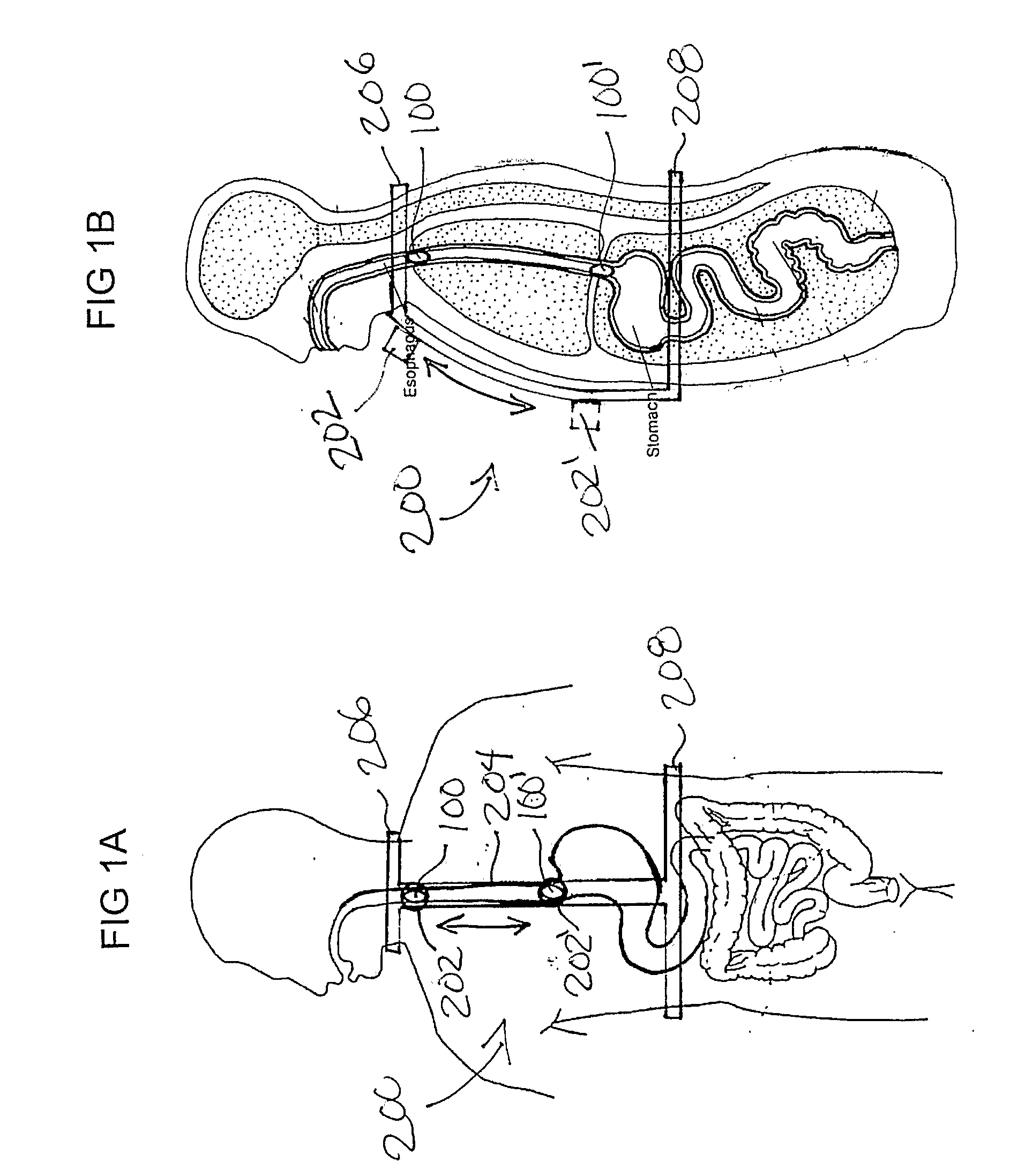 Apparatus and Methods for Capsule Endoscopy of the Esophagus