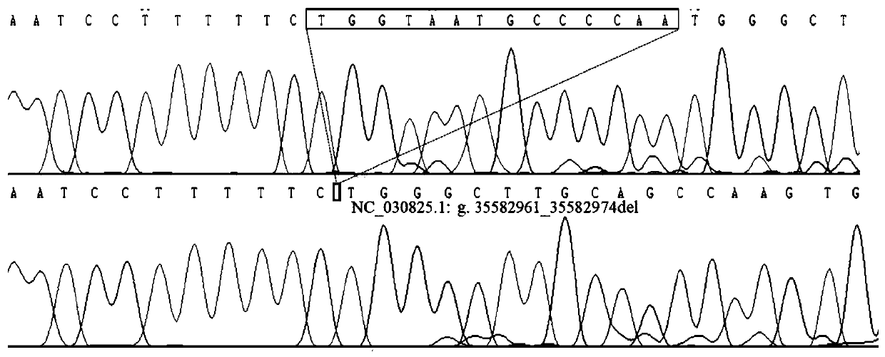 Detection method of goat CMTM2 gene insertion/deletion polymorphism and application thereof