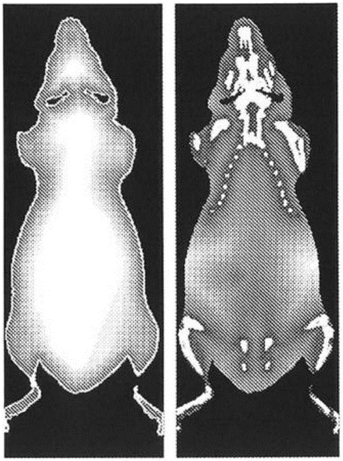 Method and system for automated detection of tissue interior to a mammalian ribcage from an in vivo image