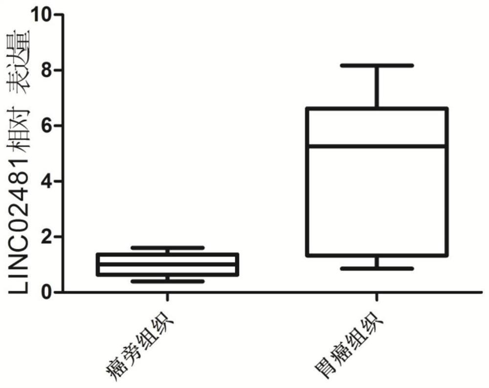 Application of long-chain non-coding RNA LINC02481 in inhibition of proliferation of gastric cancer cells and promotion of apoptosis of gastric cancer cells