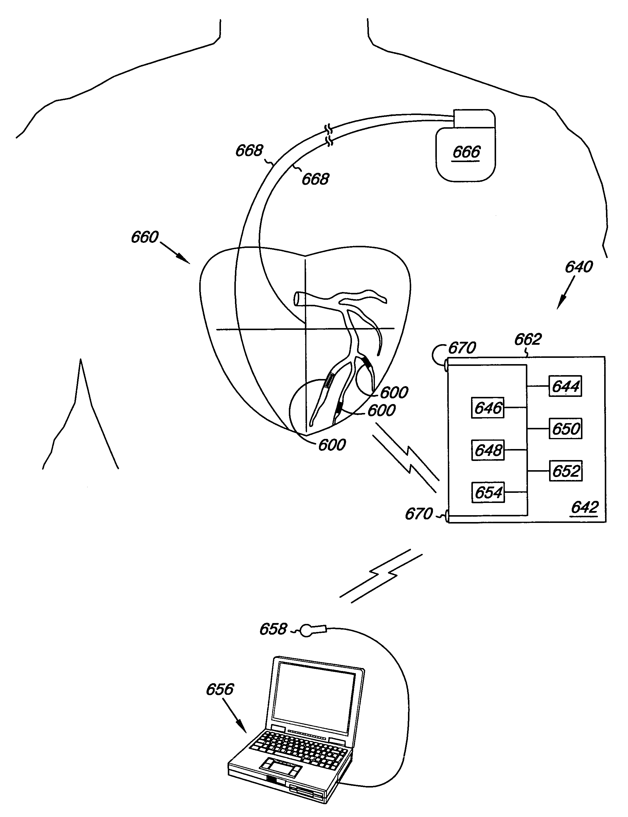 Electrode apparatus, systems and methods