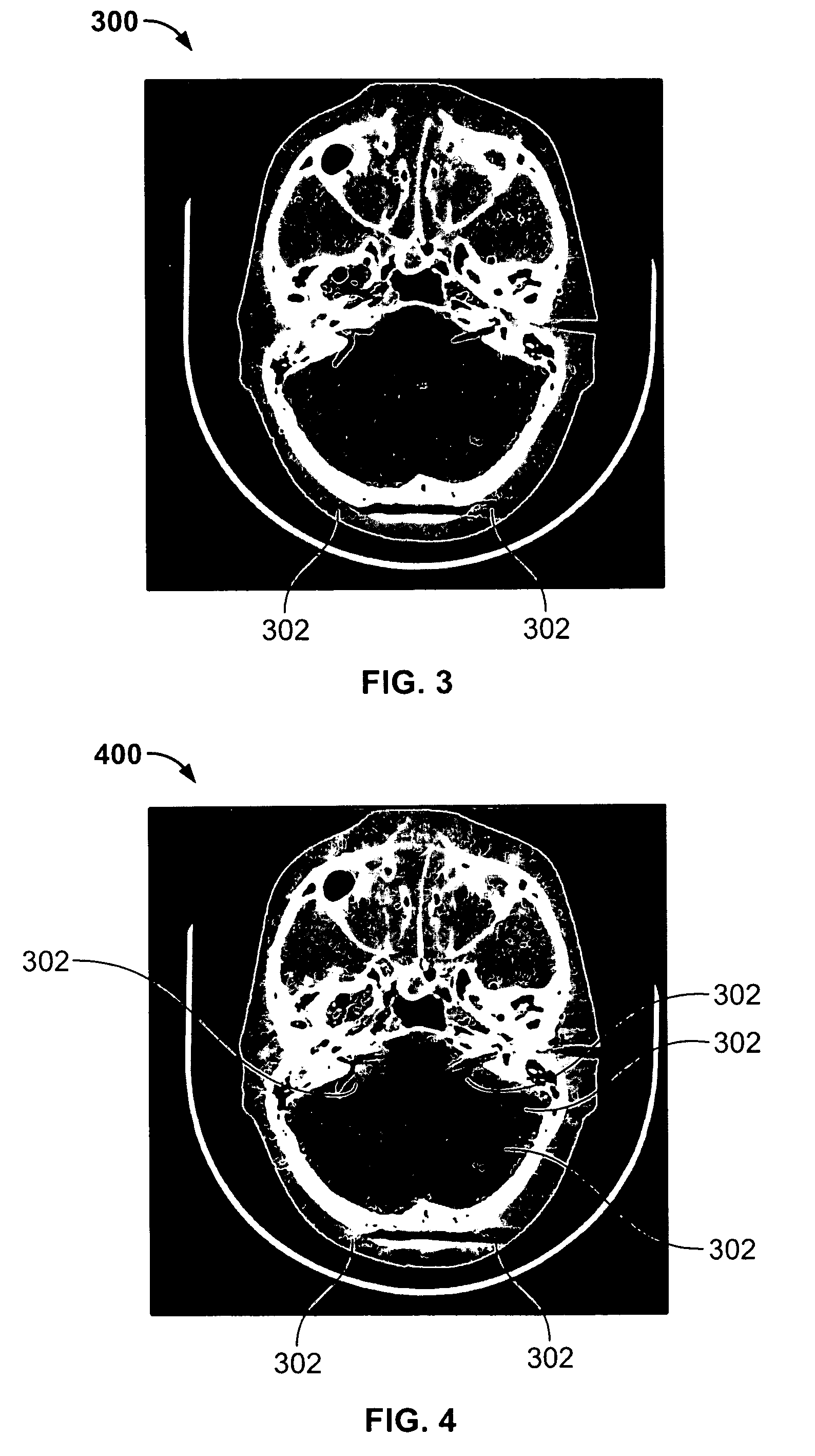 Methods and apparatus for image reconstruction