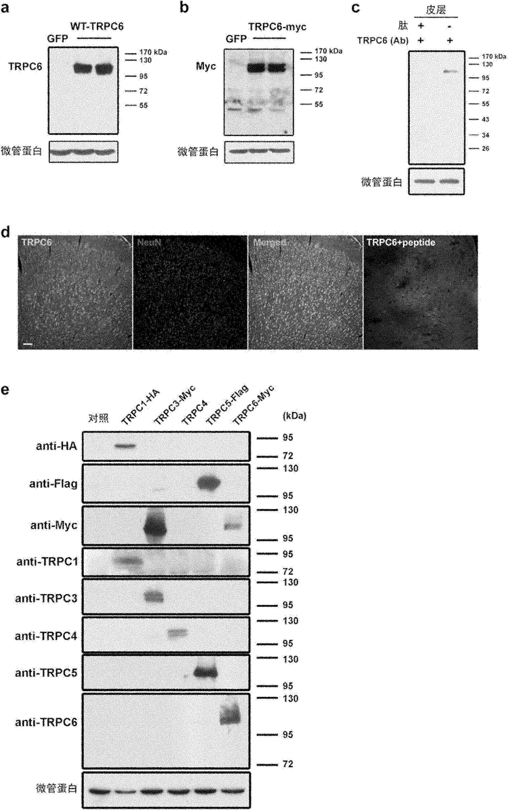 Target spot and medicine for treating cerebral injury