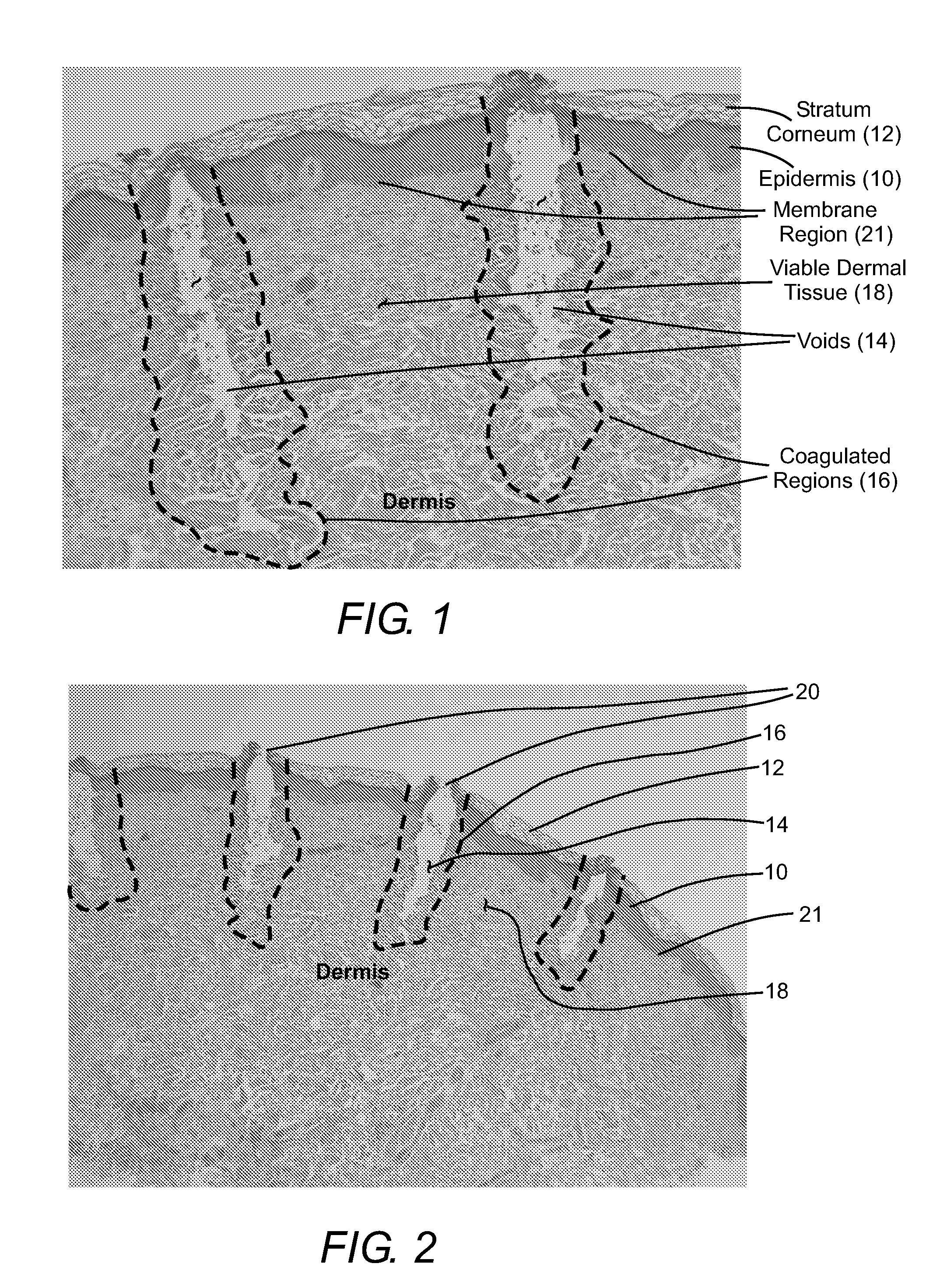 Micropore delivery of active substances