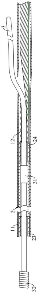 Thrombus filter