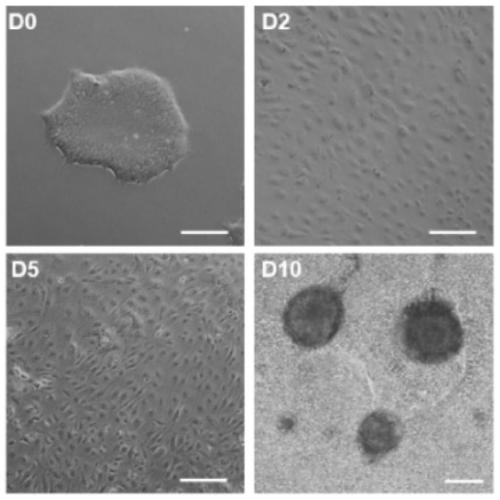 Method for in-vitro differentiation from induced pluripotent stem cells to oocyte stagnating in meiosis II stage