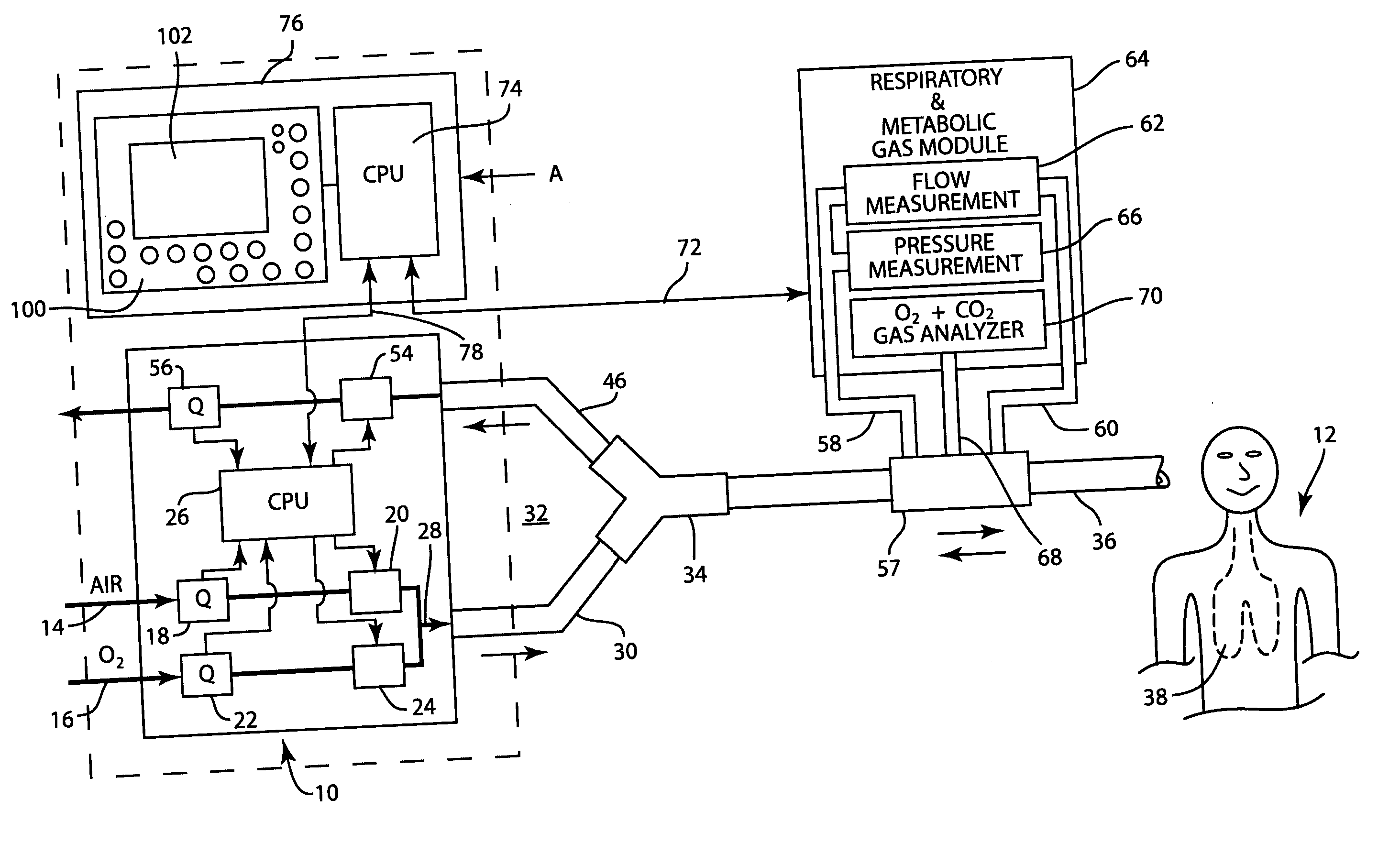 Apparatus and method for determining and displaying functional residual capacity data and related parameters of ventilated patients