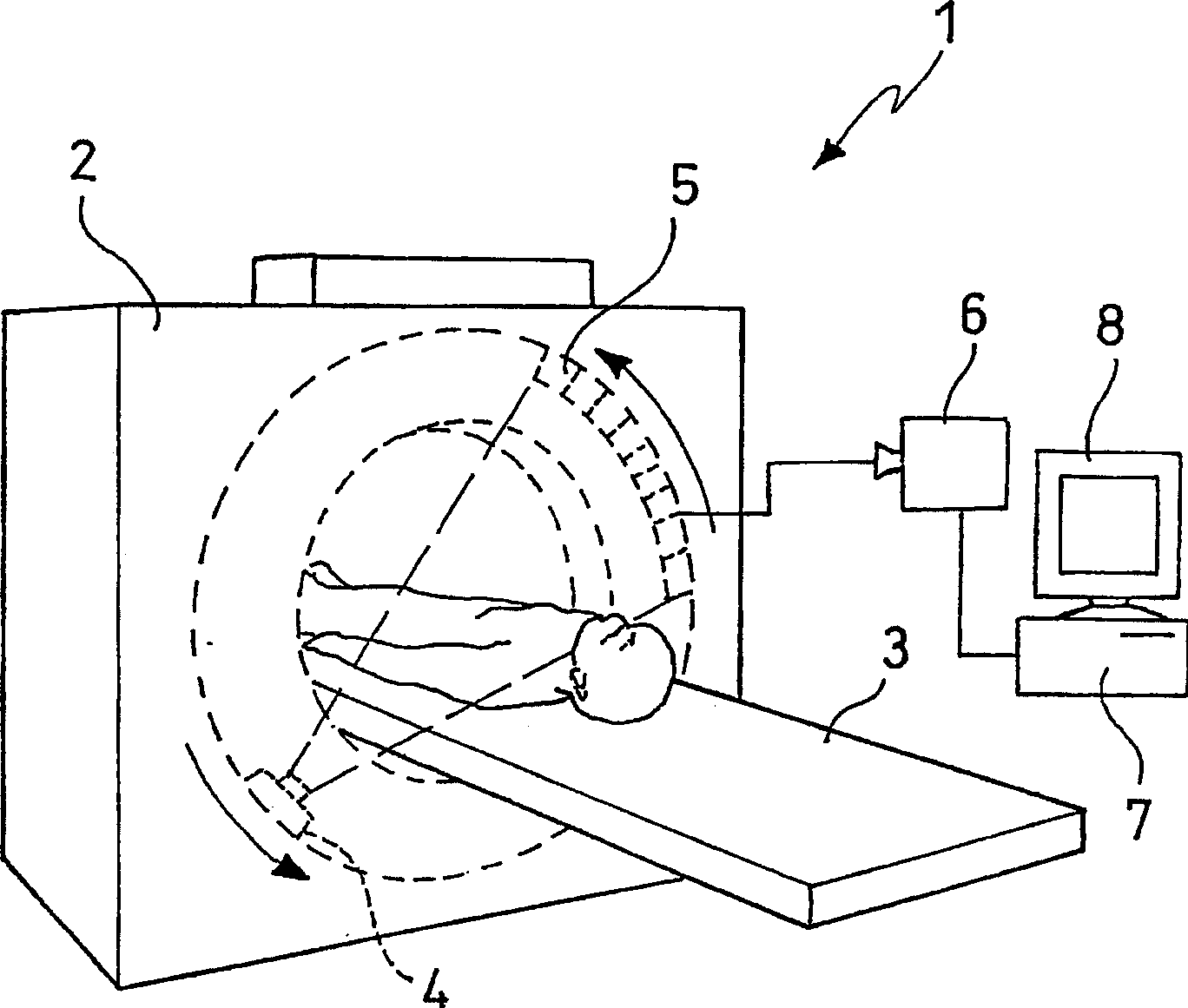 Method and apparatus for analyzing biological tissue images