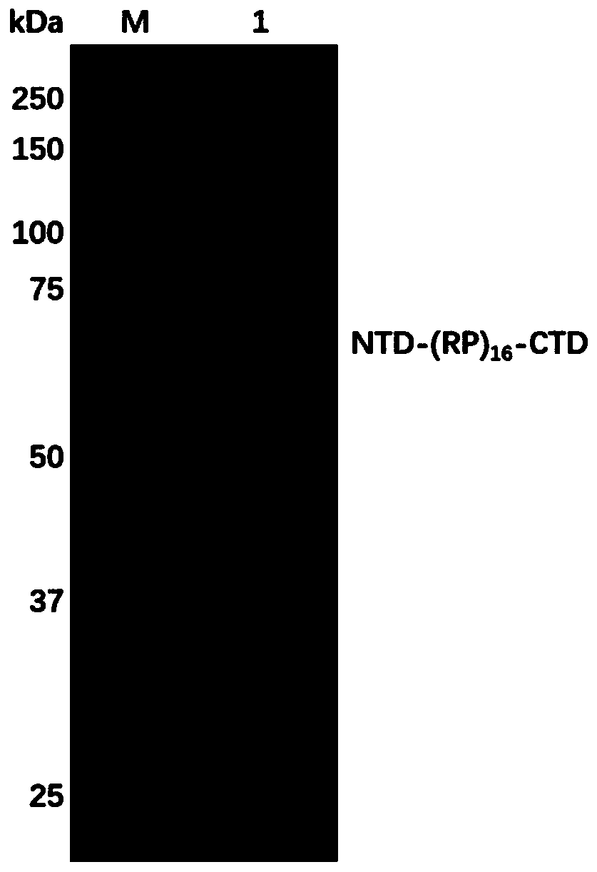 Preparation method and spinning of high-concentration recombinant spider silk protein spinning solution