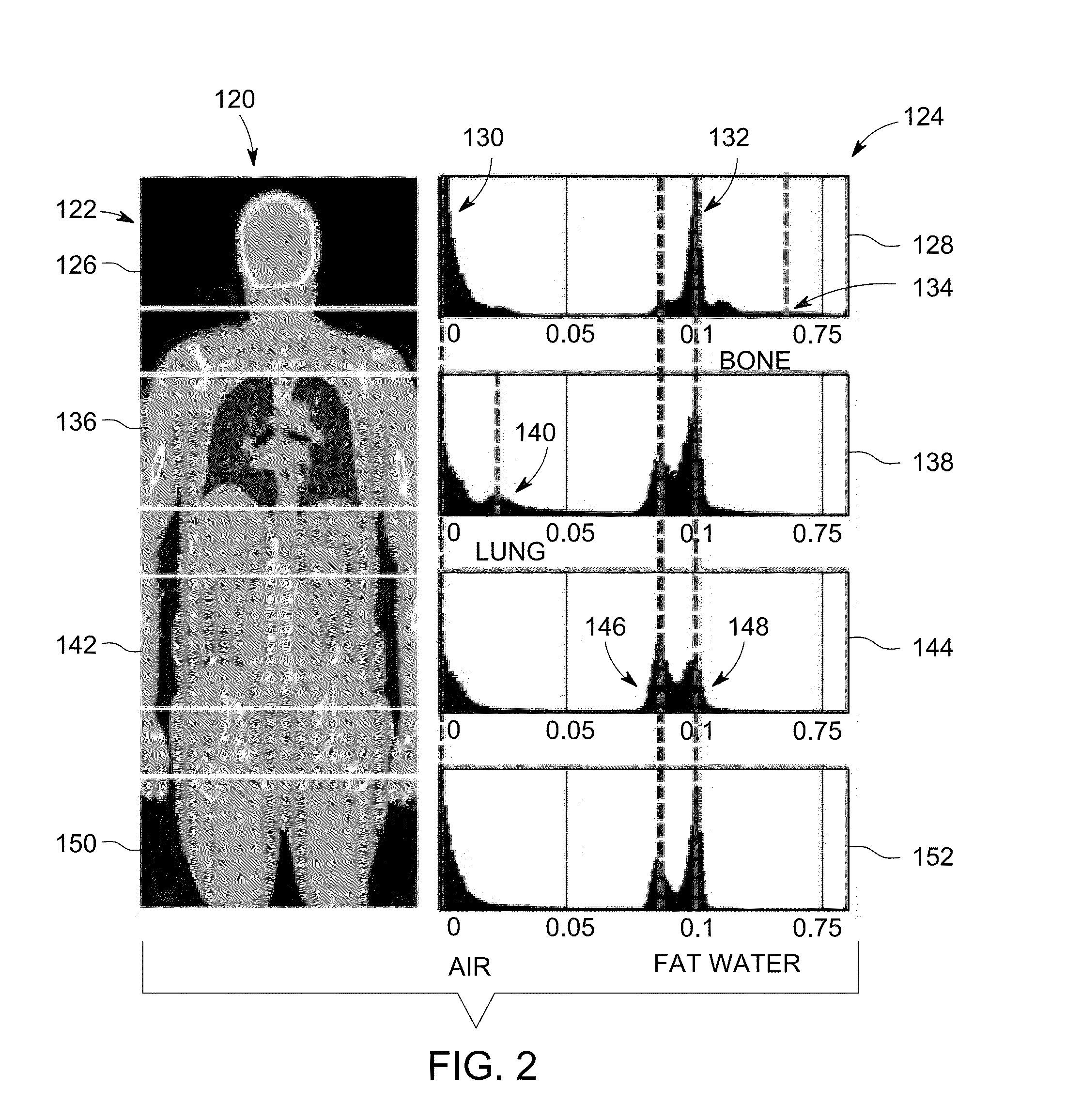 Attenuation correction in positron emission tomography using magnetic resonance imaging