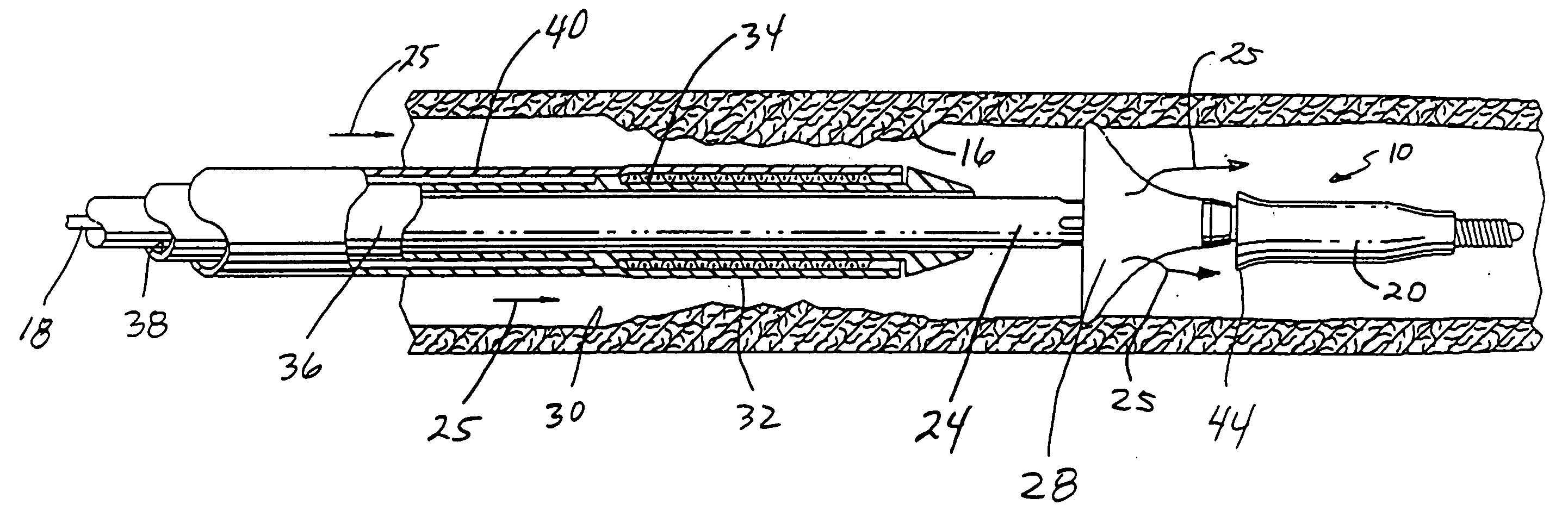 Embolic protection guide wire