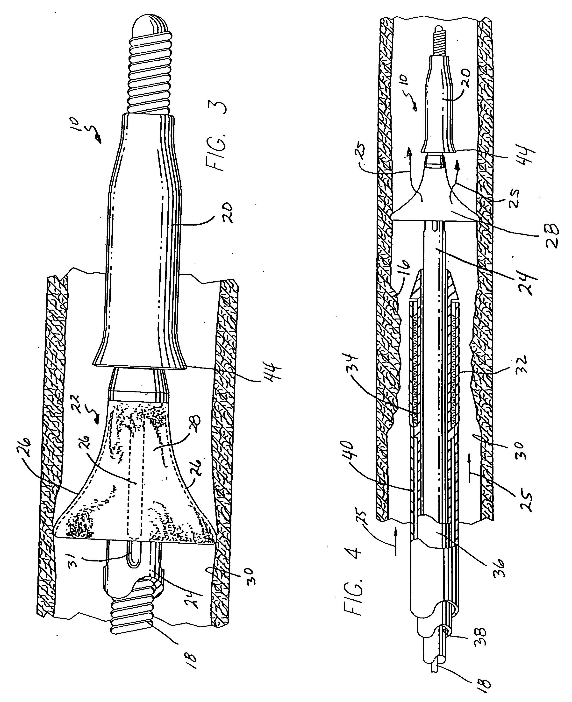 Embolic protection guide wire