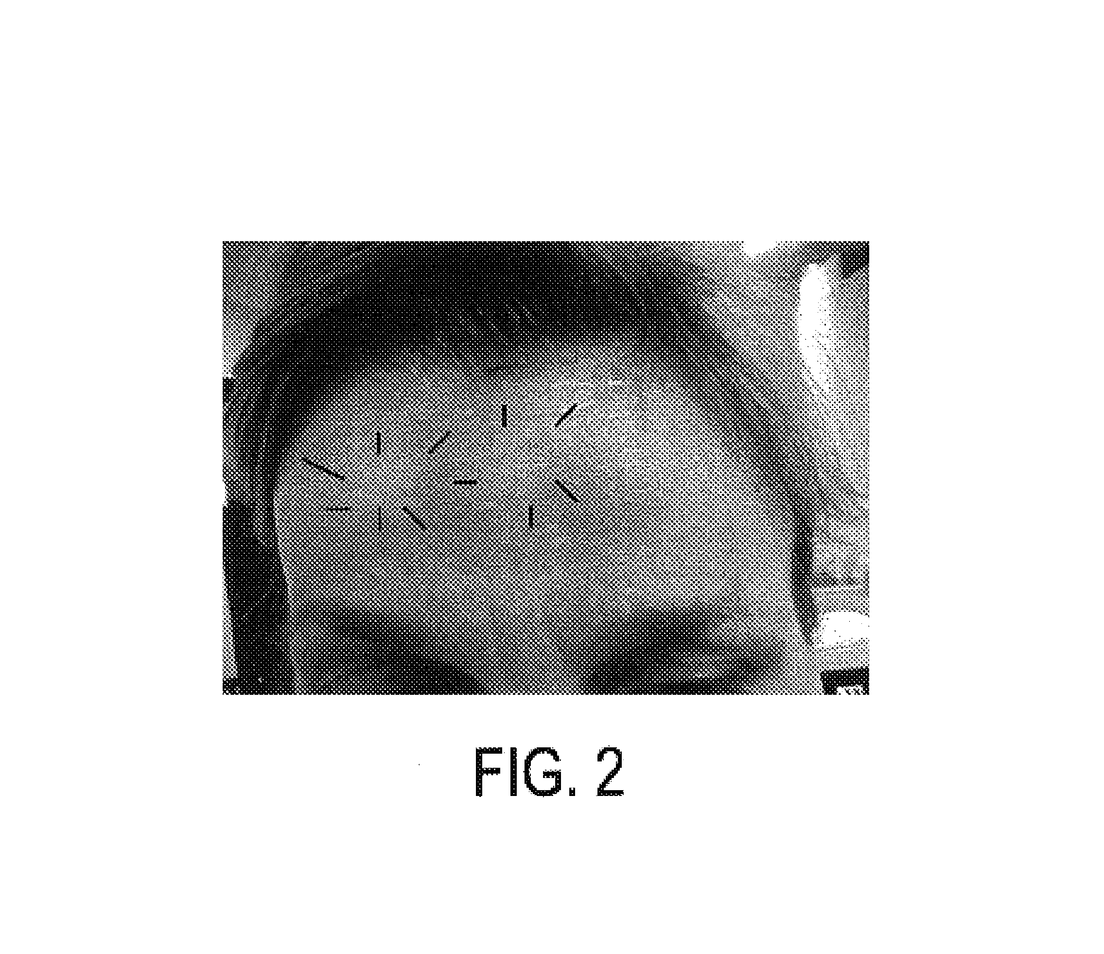 Chemodenervating pharmaceutical as anti-inflammatory agent