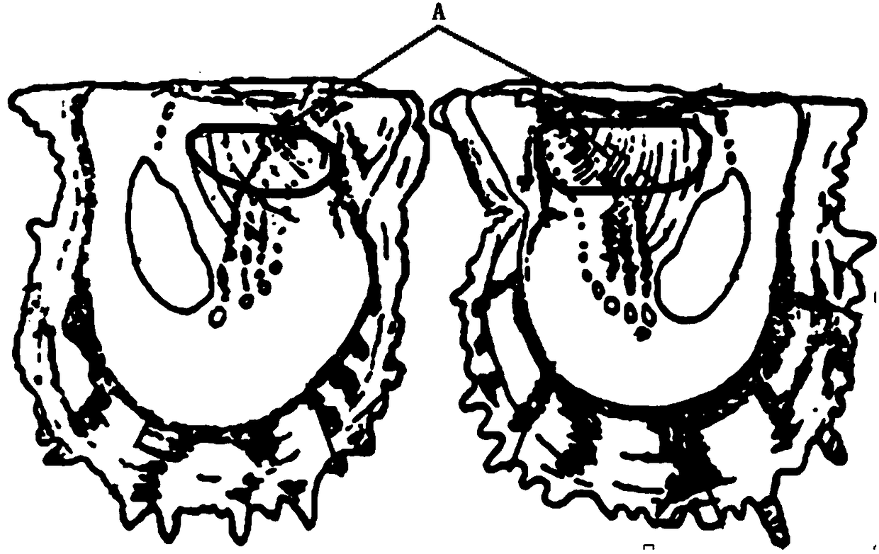 Method for breeding natural pearls through pearl oysters and obtained pearls