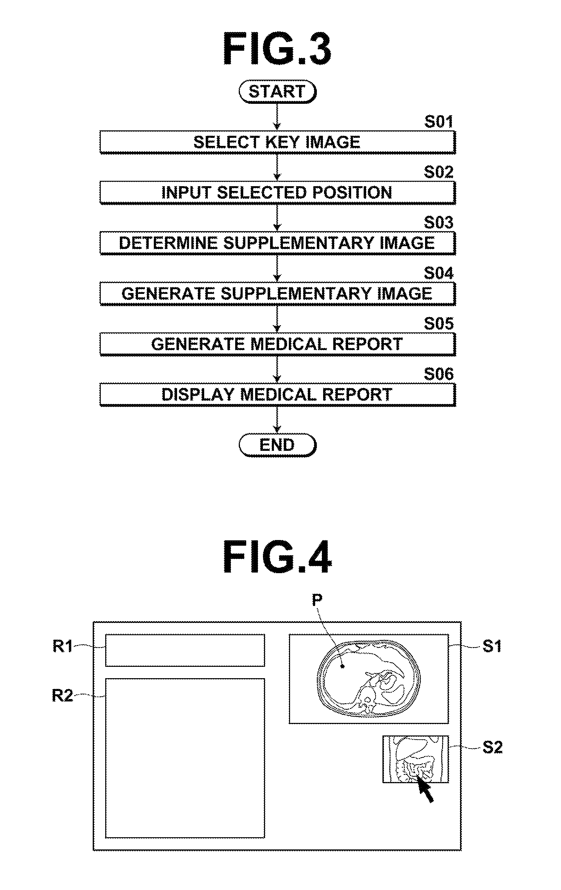 Medical report generation apparatus, method and program