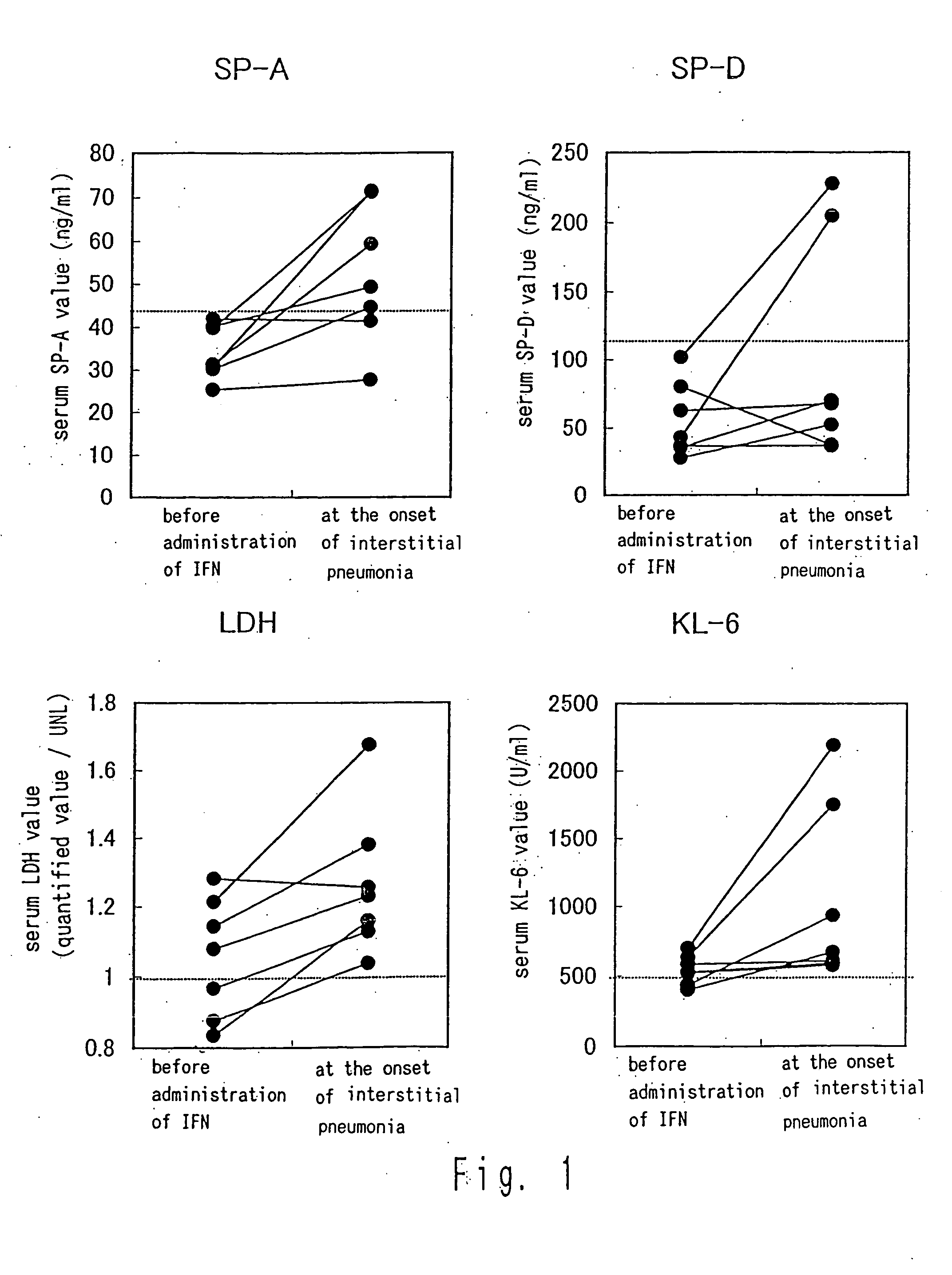 Method for predicting development of interstitial pneumonia by quantifying MUC-1