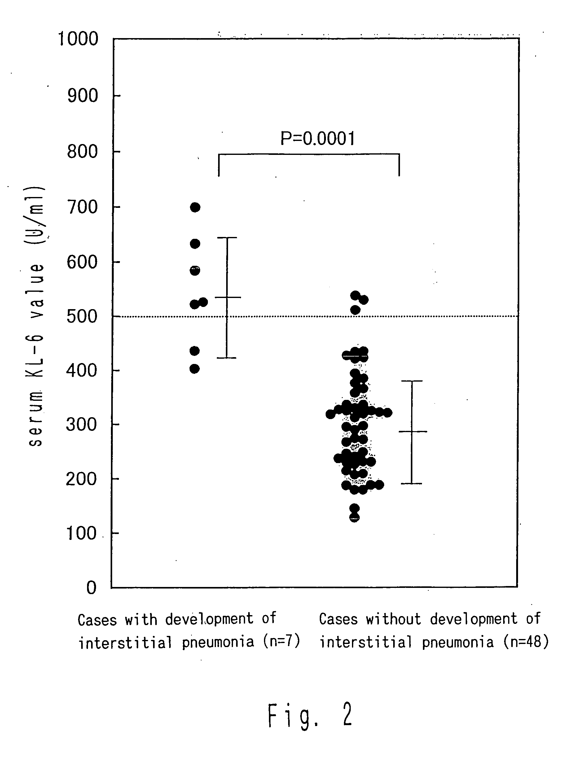 Method for predicting development of interstitial pneumonia by quantifying MUC-1