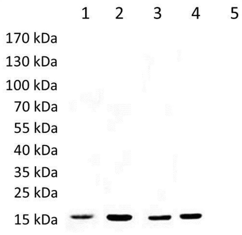 Schistosoma japonicum antigen protein rSjScP92 and application thereof