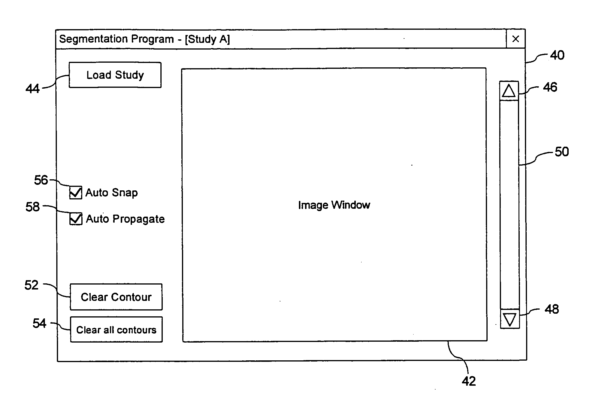 System and Method for Segmenting a Region in a Medical Image