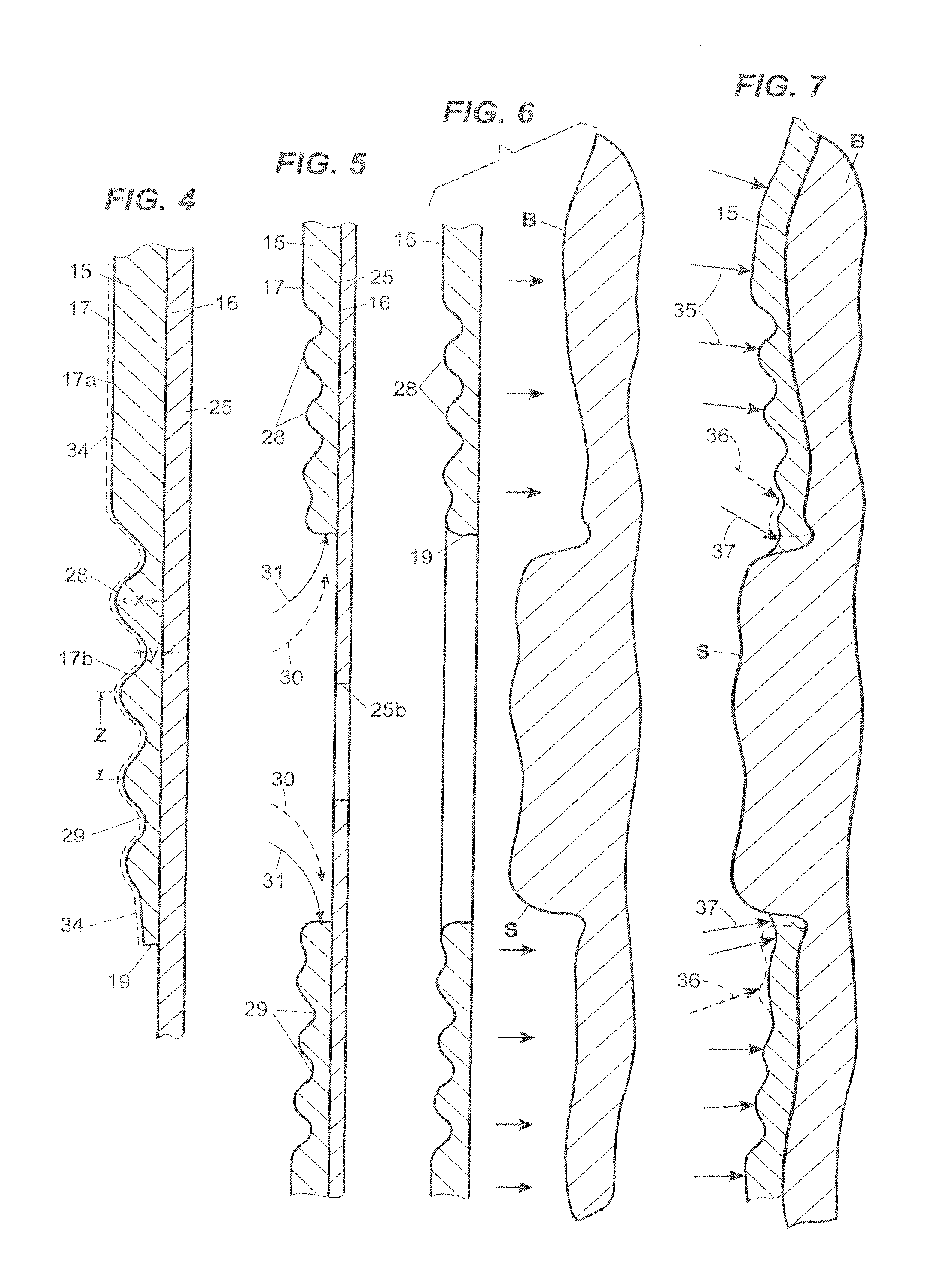 Ostomy faceplate having moldable adhesive wafer with diminishing surface undulations