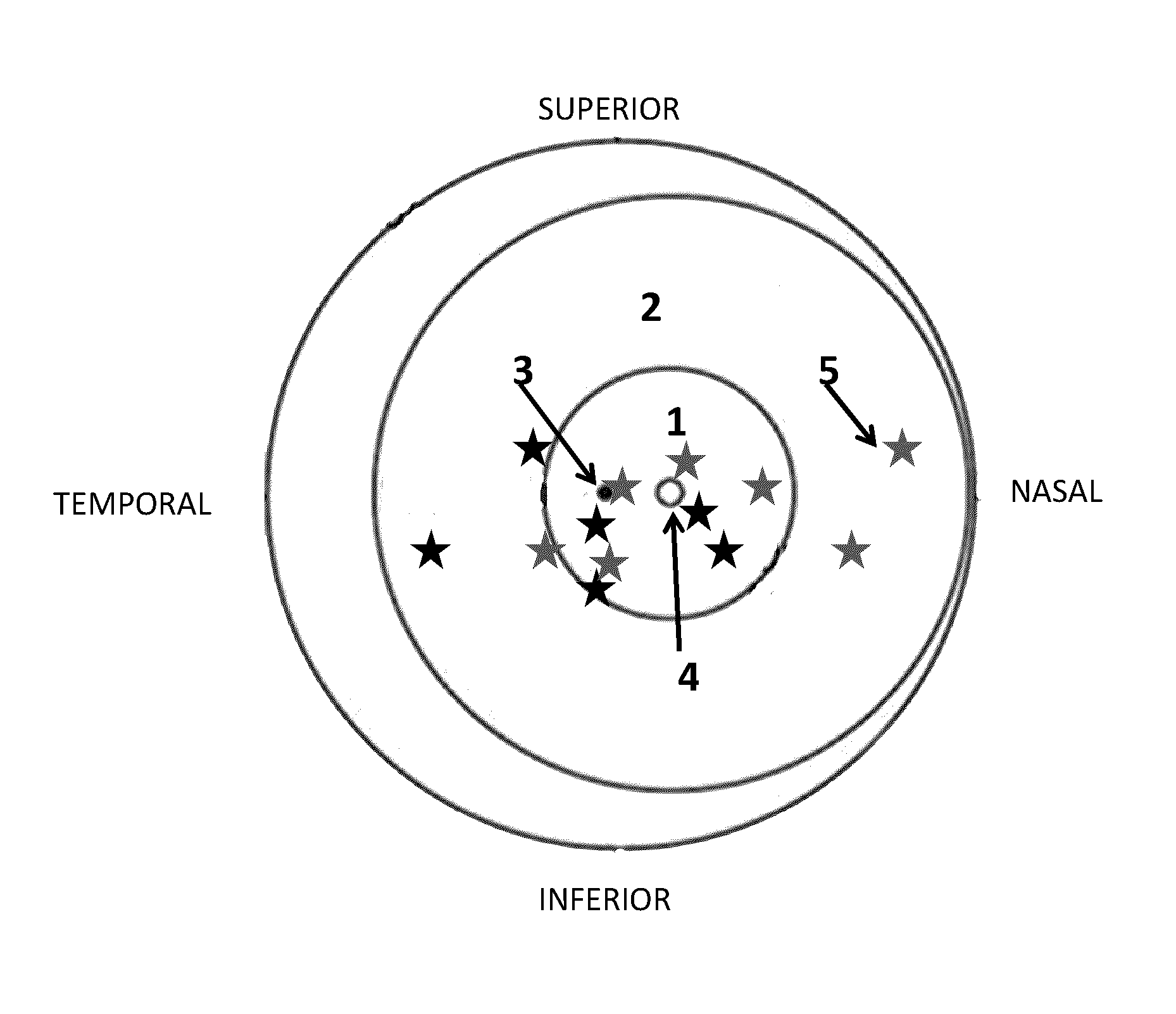 Method and system for imaging amyloid beta in the retina of the eye in association with alzheimer's disease