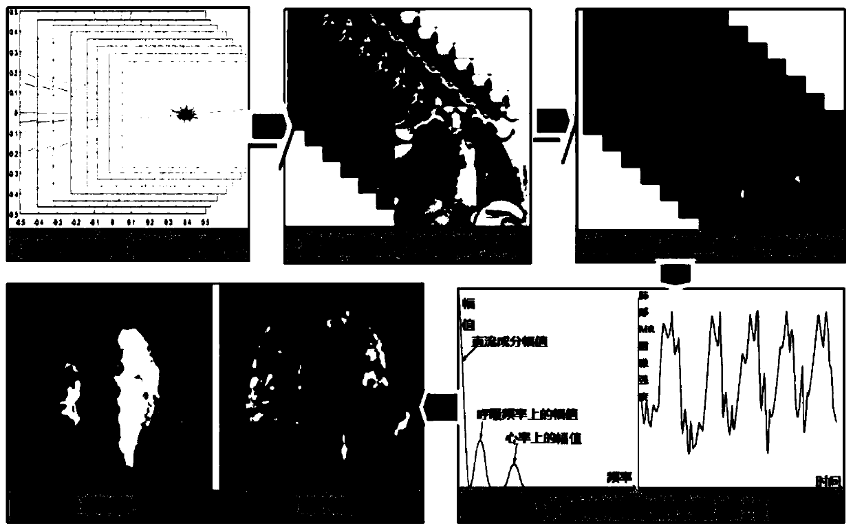 Pulmonary function imaging processing method based on magnetic resonance imaging (MRI) technology