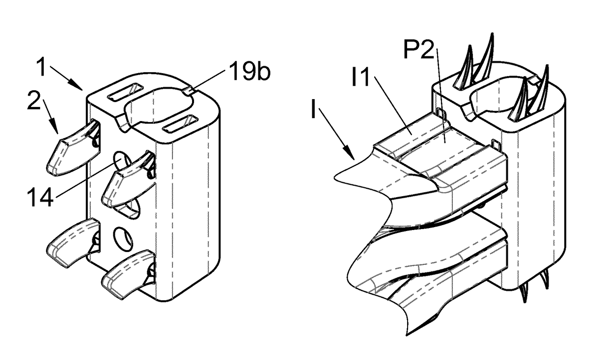 Vertebral implant, vertebral fastening device of the implant and implant instrumentation