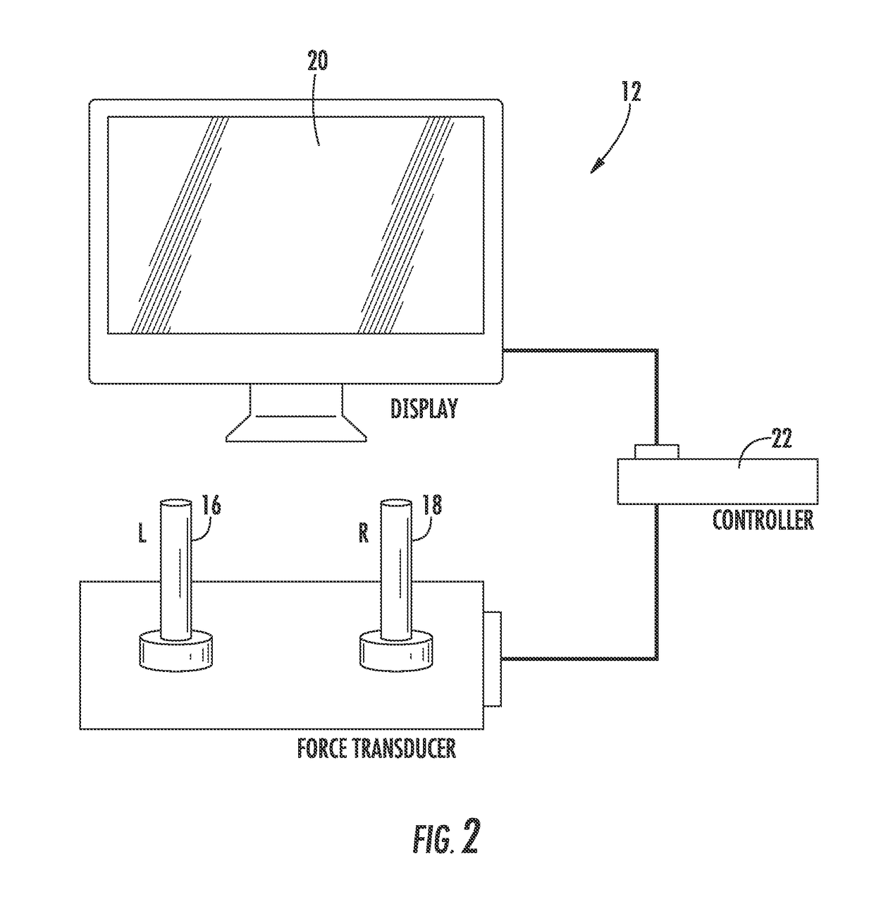 System and method for brain stimulation for improvement of motor symptoms in parkinson's disease and other movement disorders