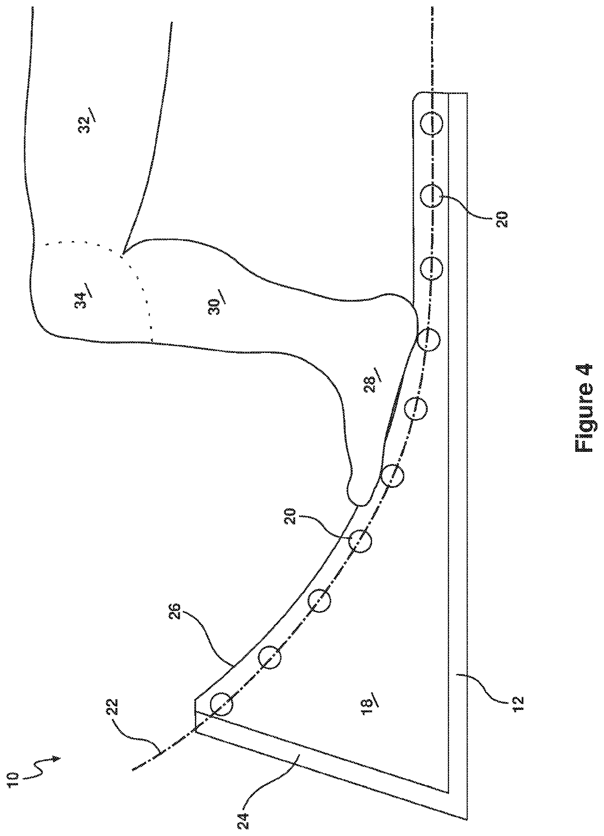 Exercise and rehabilitation apparatus