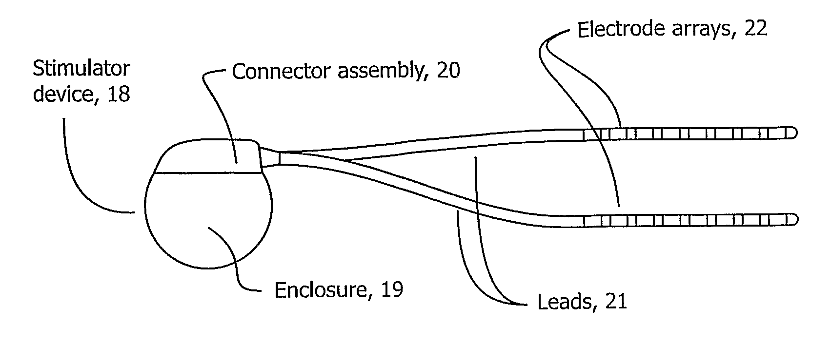 Array Stimulator