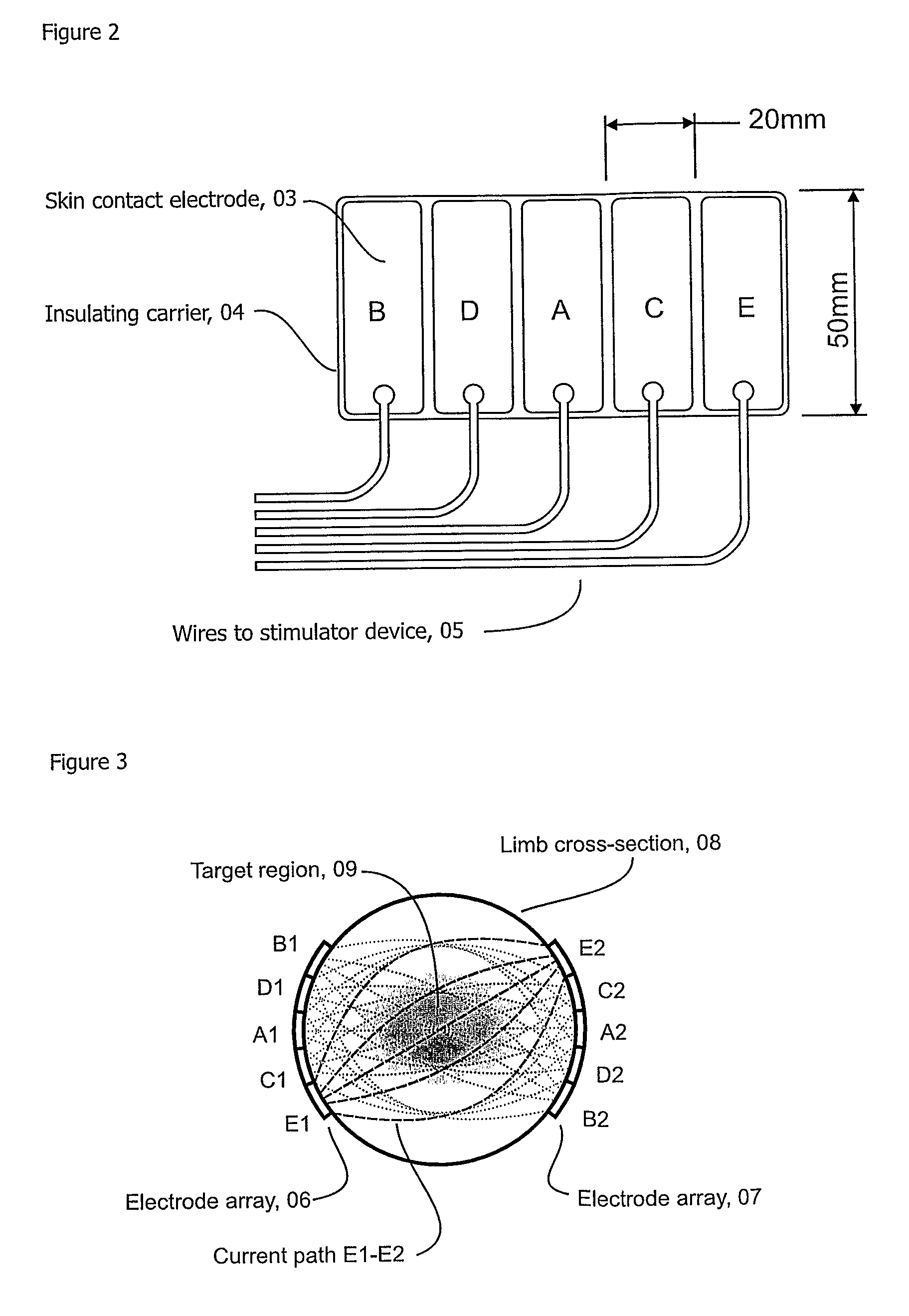 Array Stimulator