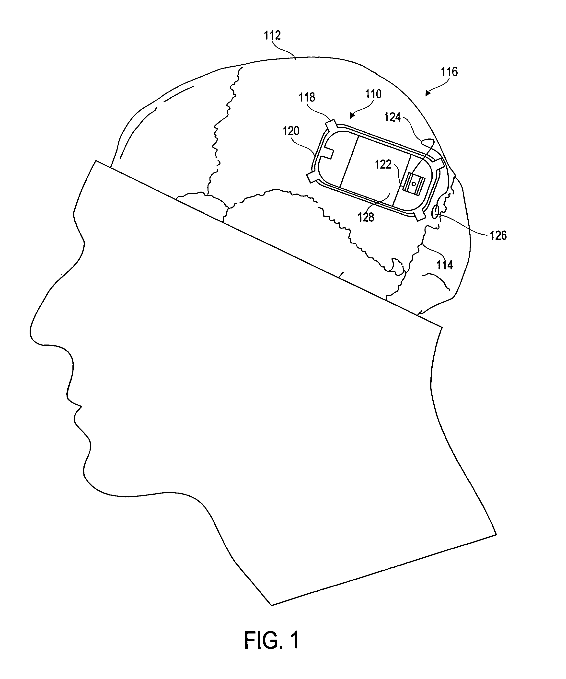 Differential neurostimulation therapy driven by physiological therapy