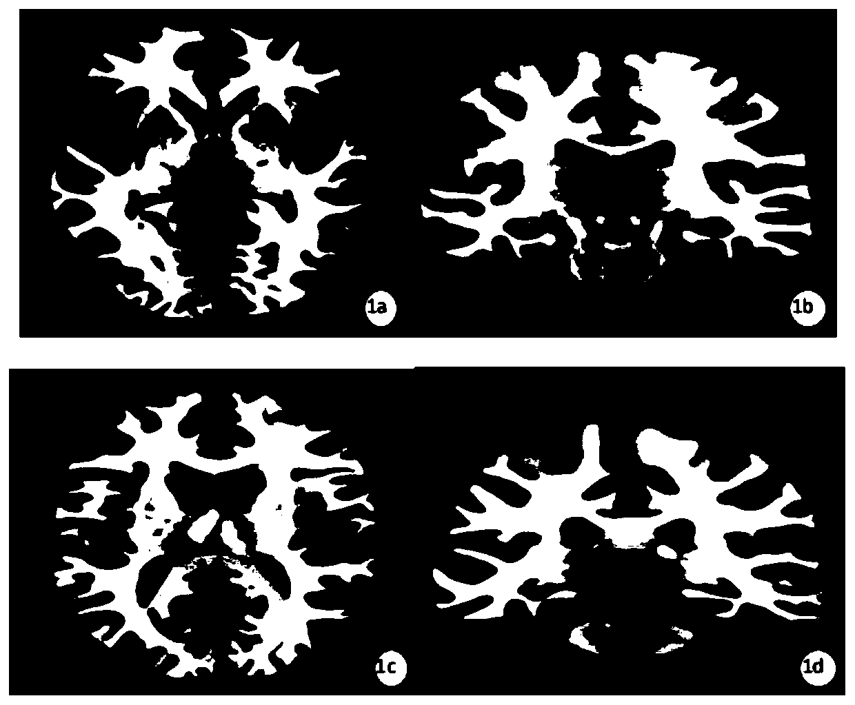 DTI-based method for determining white matter micro-structure variation of type 2 diabetic patient