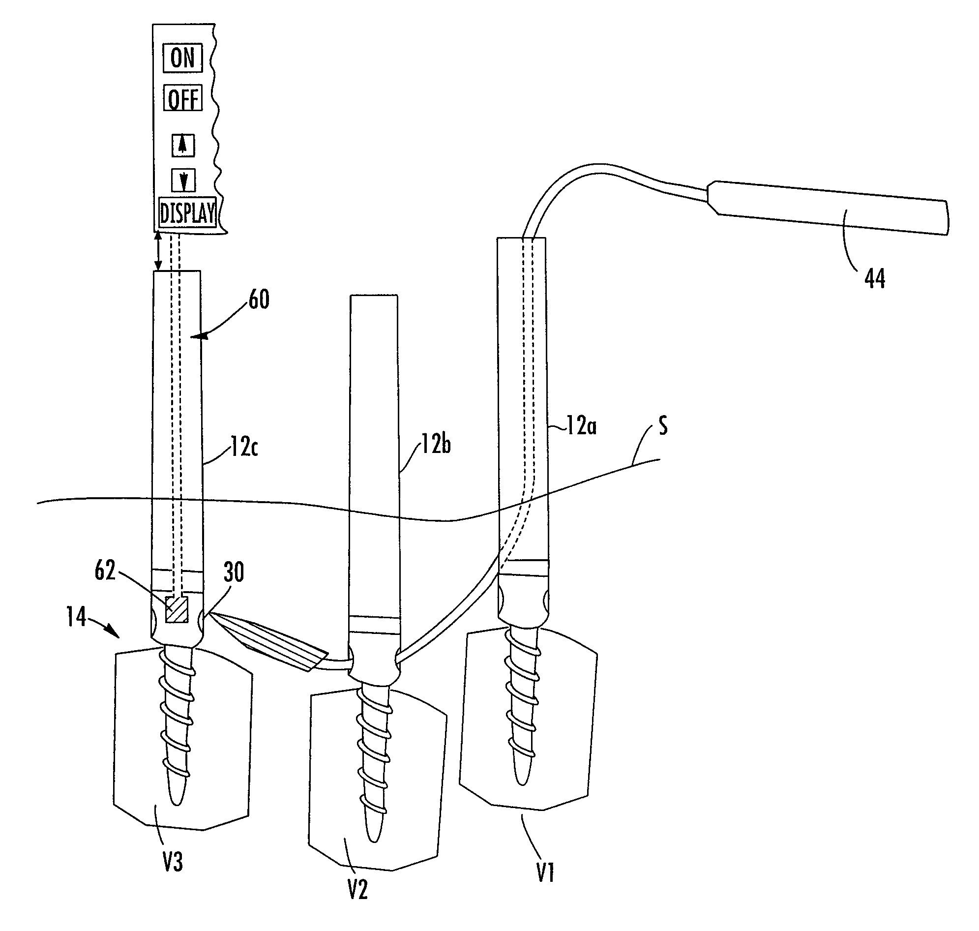 Magnetic targeting system and method of using the same