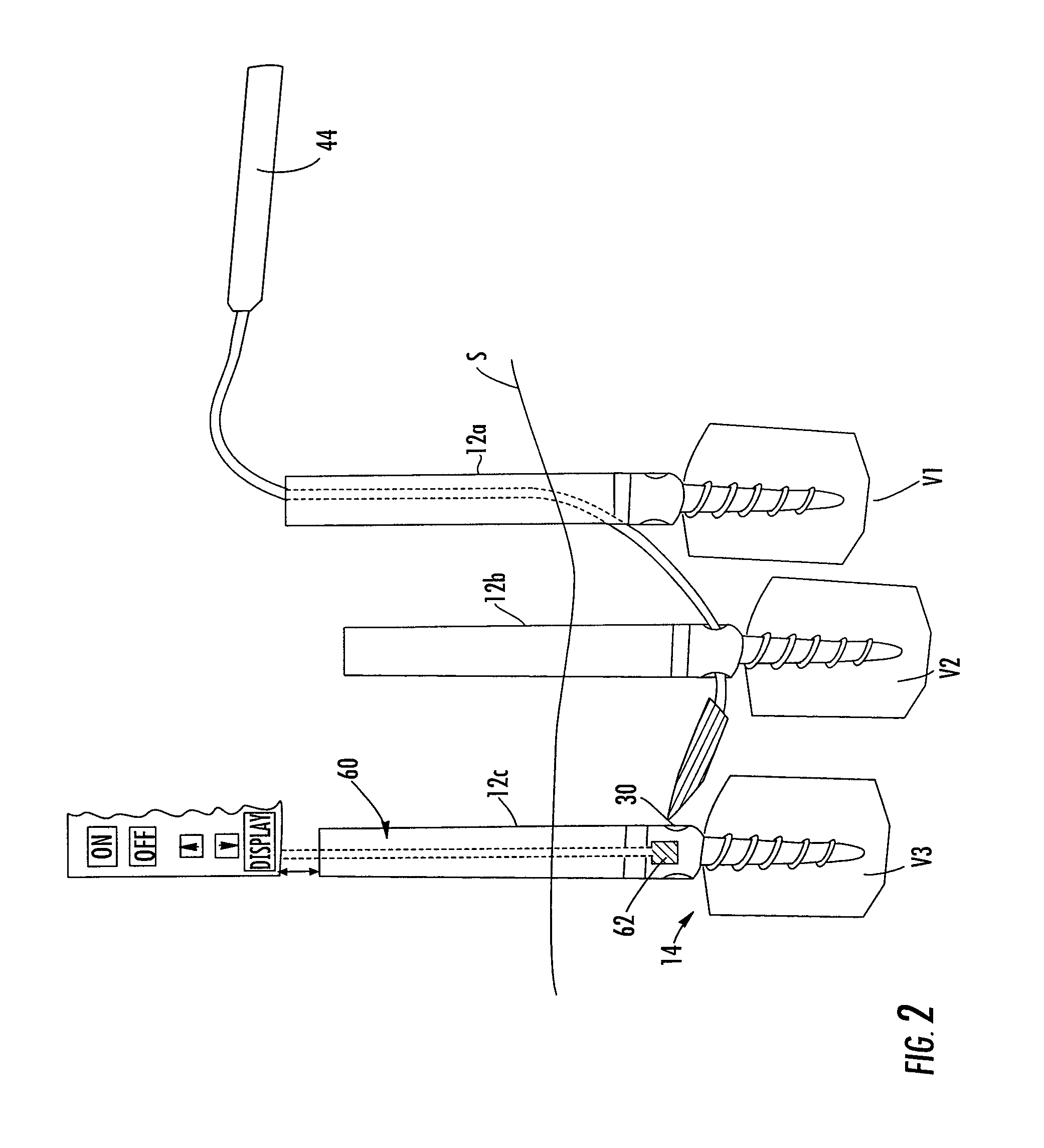 Magnetic targeting system and method of using the same