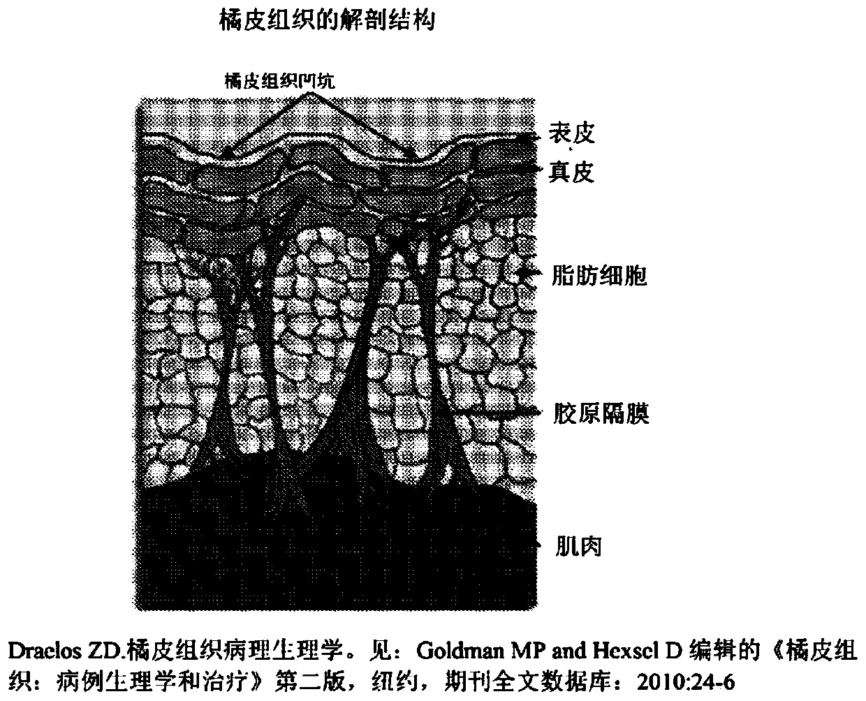 Apparatus and method for assessing and treating cellulite