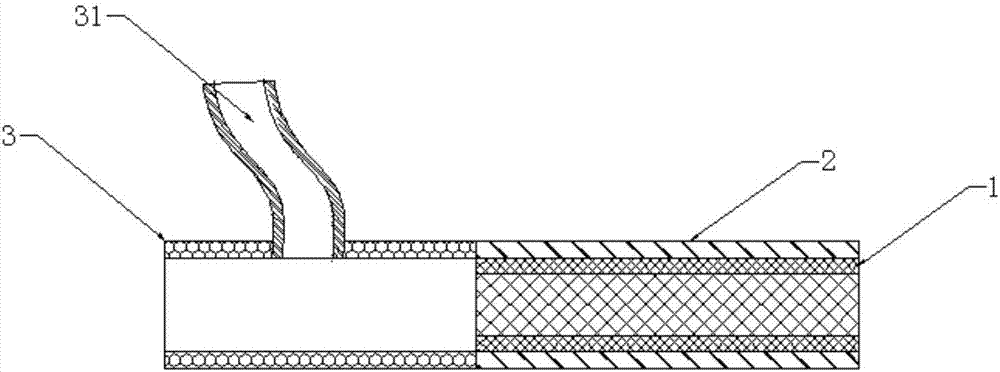 Aortic dissection stent graft